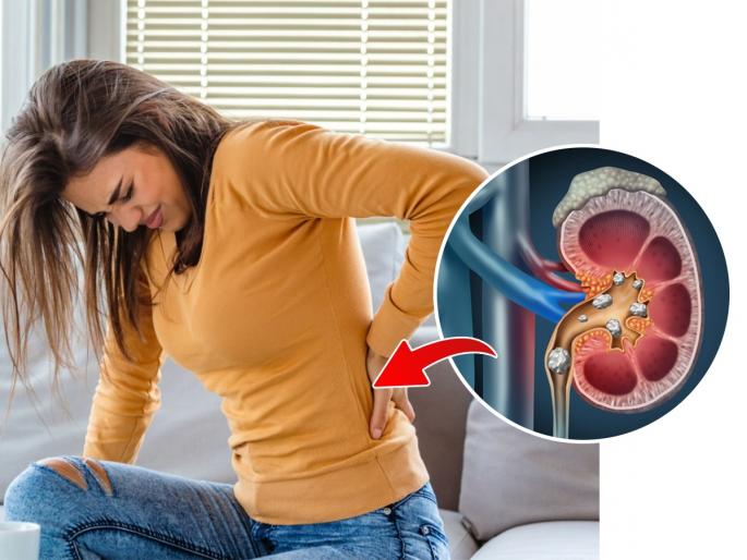 5 Mistakes That can harm Kidneys health : 5 things to avoid to maintain good kidney health; If you make a mistake here... | ५ चुका कायम करत असाल तर तुमच्या किडनीचं आरोग्य धोक्यात आहे! - सोप्या गोष्टी, आजार टाळा