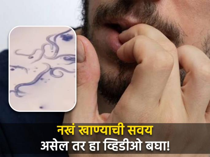 You will never bite nails with teeth after watch this video | तुम्हालाही नखं खाण्याची सवय आहे का? हा व्हिडीओ पाहून सुटेल तुमची सवय You will never bite nails with teeth after watch this video | तुम्हालाही नखं खाण्याची सवय आहे का? हा व्हिडीओ पाहून सुटेल तुमची सवय