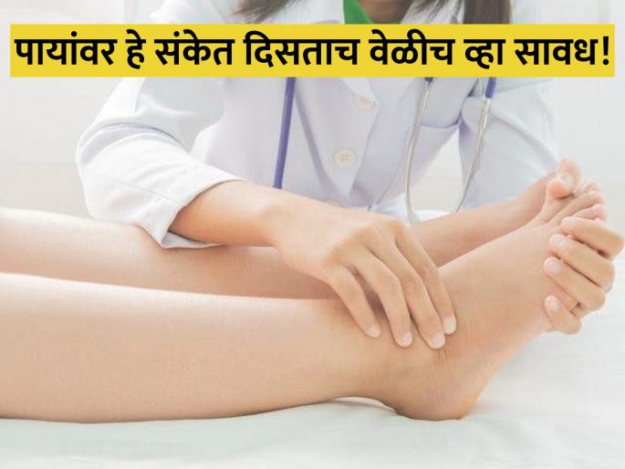 Diabetes Symptoms : Toes reveal about your health don't ignore these signs | पायांवर दिसणाऱ्या या संकेतांकडे अजिबात करू नका दुर्लक्ष, असू शकतो डायबिटीसचा संकेत Diabetes Symptoms : Toes reveal about your health don't ignore these signs | पायांवर दिसणाऱ्या या संकेतांकडे अजिबात करू नका दुर्लक्ष, असू शकतो डायबिटीसचा संकेत