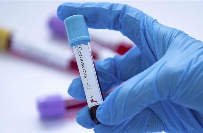 corona in Gadchiroli, which has been a green zone till now | आतापर्यंत ग्रीन झोन असलेल्या गडचिरोलीत कोरोनाचा शिरकाव corona in Gadchiroli, which has been a green zone till now | आतापर्यंत ग्रीन झोन असलेल्या गडचिरोलीत कोरोनाचा शिरकाव