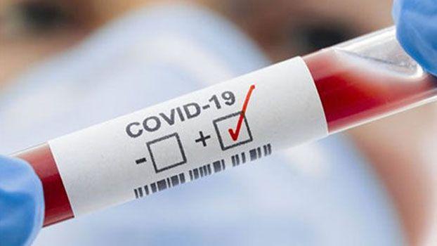 Corona not tested, though SMS of ‘positive’ report; Confusion and fear among the citizens | कोरोनाची चाचणी नाही, तरी ‘पॉझिटिव्ह’ अहवालाचा एसएमएस; नागरिकात संभ्रम व भीती Corona not tested, though SMS of ‘positive’ report; Confusion and fear among the citizens | कोरोनाची चाचणी नाही, तरी ‘पॉझिटिव्ह’ अहवालाचा एसएमएस; नागरिकात संभ्रम व भीती