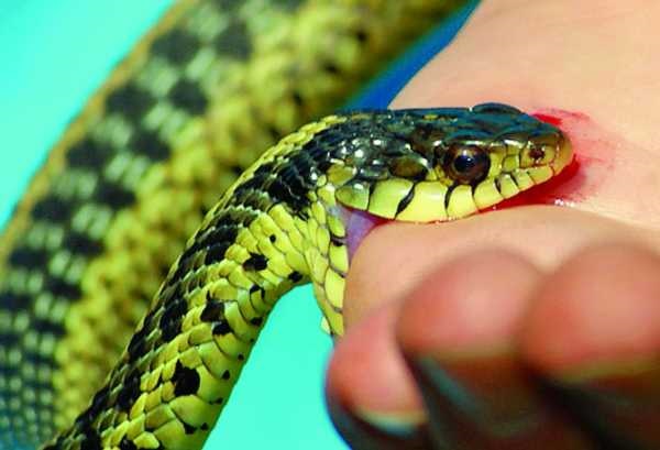64 incidents of snake bites in Solapur; Know ... the next health problem after a snake bite | साप चावल्याच्या सोलापुरात ६४ घटना; जाणून घ्या... सर्पदंशानंतर पुढच्या आरोग्यविषयक समस्या