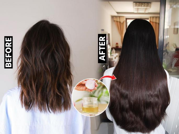 4 Natural ingredients for hair growth Hair Care tips : Hair thinning and thinning, looking bald? Use 4 ingredients, hair will be thick and long in a month | केस गळून-गळून खूप पातळ झाले, टक्कल दिसते? वापरा ४ पदार्थ, महिन्याभरात केस होतील जाड-लांबसडक