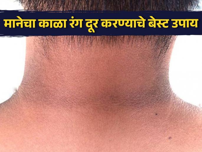 Amazing home remedies to get rid of black neck | लगेच दूर होईल मानेचा काळा रंग, घरीच करा हे 5 बेस्ट उपाय