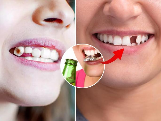 Important tips for Healthy Teeth and gums : Do only 4 things to keep your teeth strong forever; Teeth will not fall even if you grow old... | दात कायम मजबूत राहण्यासाठी करा फक्त ४ गोष्टी; दातांना कीड लागणार नाही