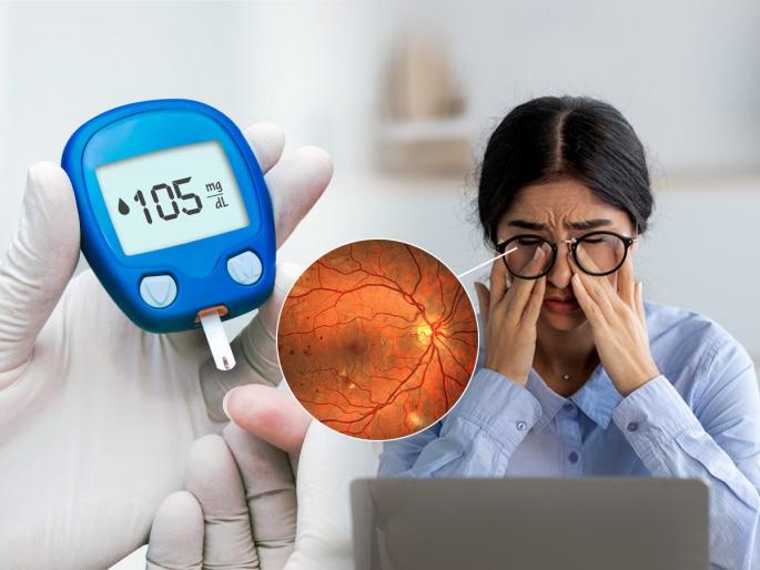 Risk Of Diabetic Retinopathy To Diabetic Patients : Constantly high blood sugar? Protect your eyes, experts say, risk of developing diabetic retinopathy... | रक्तातील शुगर सतत वाढते? डोळे जपा, तज्ज्ञ सांगतात, डायबिटीक रेटीनोपॅथी होण्याचा धोका...