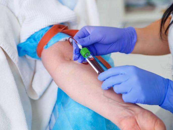 Double duration of corona patients in rural areas at 18 days | Good News; ग्रामीण भागातील कोरोना रुग्ण दुपटीचा कालावधी १८ दिवसांवर Double duration of corona patients in rural areas at 18 days | Good News; ग्रामीण भागातील कोरोना रुग्ण दुपटीचा कालावधी १८ दिवसांवर