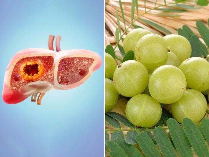 Gooseberry or amla benefits for hair, skin, eyes, heart attack, liver cancer and beat aging | लिव्हर कॅन्सरपासून बचाव करतो आवळा, शरीरातील सगळे अवयव करतो मजबूत Gooseberry or amla benefits for hair, skin, eyes, heart attack, liver cancer and beat aging | लिव्हर कॅन्सरपासून बचाव करतो आवळा, शरीरातील सगळे अवयव करतो मजबूत