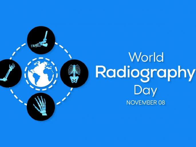 why-world-radiography-day-being-celebrated-today-know-who-invented-xray-machine | आज 'जागतिक रेडिओग्राफी दिवस' का साजरा केला जातो ? एक्स रे चा शोध कसा लागला जाणून घ्या why-world-radiography-day-being-celebrated-today-know-who-invented-xray-machine | आज 'जागतिक रेडिओग्राफी दिवस' का साजरा केला जातो ? एक्स रे चा शोध कसा लागला जाणून घ्या