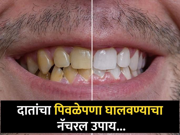Use mulethi powder and curd for teeth whitening home remedies | दात पिवळे असल्याने चारचौघात हसताही येत नाही? हा सोपा उपाय करून दात करा चमकदार! Use mulethi powder and curd for teeth whitening home remedies | दात पिवळे असल्याने चारचौघात हसताही येत नाही? हा सोपा उपाय करून दात करा चमकदार!