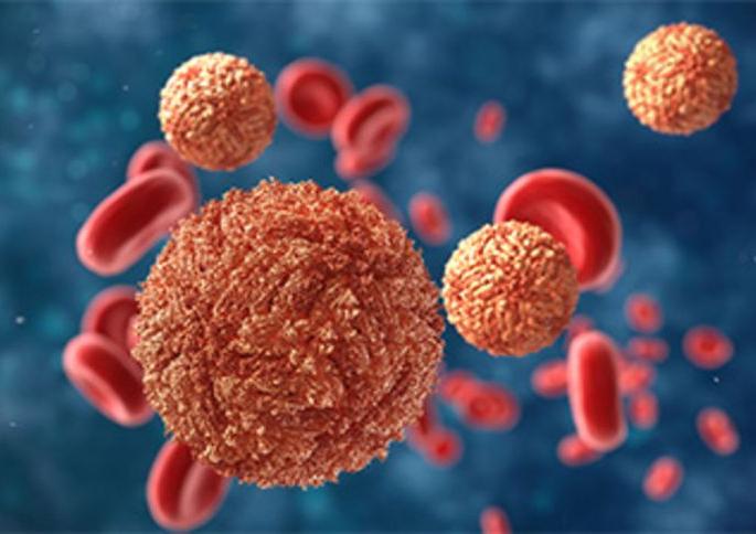 Brain lesions in newborns due to Zika virus | झिका विषाणूमुळे नवजात बालकांच्या मेंदूमध्ये विकृती