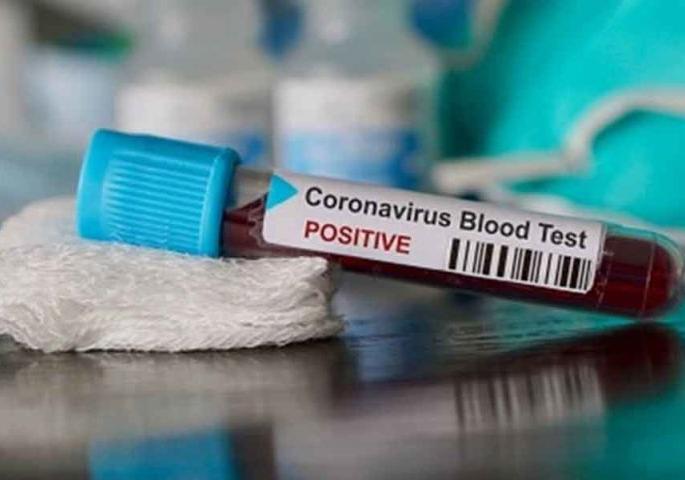 a woman from Spain, came to Nagpur detect corona positive | स्पेनहून नागपुरात आलेली महिला कोरोना पॉझिटिव्ह a woman from Spain, came to Nagpur detect corona positive | स्पेनहून नागपुरात आलेली महिला कोरोना पॉझिटिव्ह