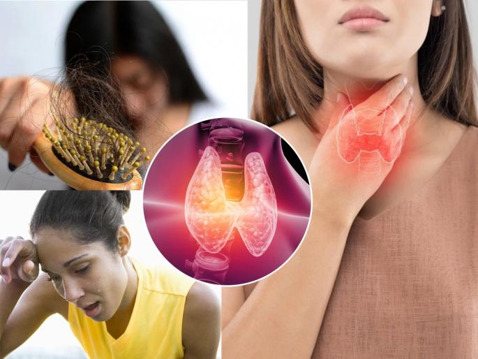 World Thyroid Day: 5 Symptoms Signs of Thyroid Problem, Avoid Ignoring - See a Doctor | World Thyroid Day : ५ लक्षणं देतात थायरॉईडचा त्रास असल्याचे संकेत, दुर्लक्ष टाळा-डॉक्टरांना भेटा