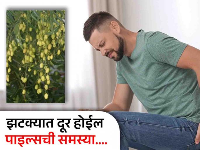 Ayurved doctor told best Ayurvedic treatment to get rid of piles | मूळव्याधामुळे उठणं-बसणं अवघड झालंय? आयुर्वेद डॉक्टरांनी सांगितला एक खास उपाय Ayurved doctor told best Ayurvedic treatment to get rid of piles | मूळव्याधामुळे उठणं-बसणं अवघड झालंय? आयुर्वेद डॉक्टरांनी सांगितला एक खास उपाय