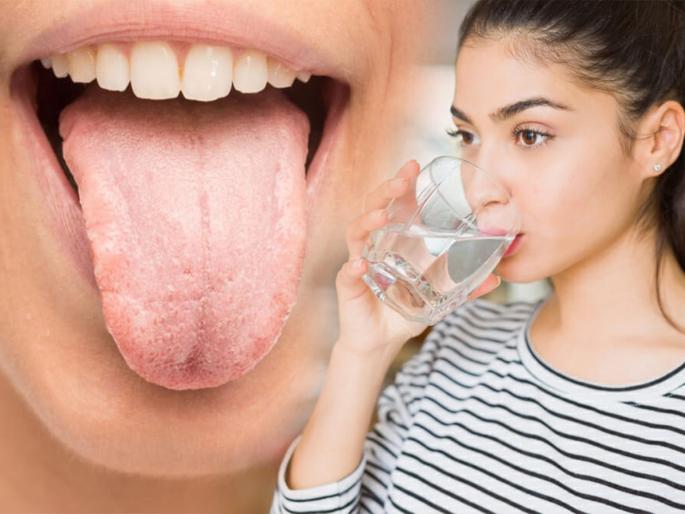 Mouth is constantly dry, drinking water continuously ? Experts say causes and remedies ... | तोंड सतत कोरडं पडतं, जीव पाणी पाणी होतो? तज्ज्ञ सांगतात कारणं आणि उपाय...