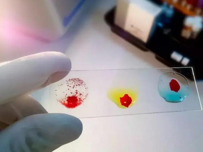 Gujarat is one of the top 10 people in the world; Everyone was shocked by the unique blood type | जगातील मोजक्या १० लोकांमध्ये गुजरातच्या व्यक्तीचा समावेश; अनोख्या रक्तगटाने बसला सर्वांना धक्का Gujarat is one of the top 10 people in the world; Everyone was shocked by the unique blood type | जगातील मोजक्या १० लोकांमध्ये गुजरातच्या व्यक्तीचा समावेश; अनोख्या रक्तगटाने बसला सर्वांना धक्का