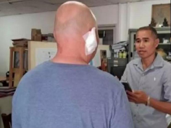 A sex worker in Thailand chewed off a client's ear while drunk | धक्कादायक! सेक्स वर्करने दारूच्या नशेत ग्राहकाचा चघळला कान, आरोपी पोलिसांच्या ताब्यात A sex worker in Thailand chewed off a client's ear while drunk | धक्कादायक! सेक्स वर्करने दारूच्या नशेत ग्राहकाचा चघळला कान, आरोपी पोलिसांच्या ताब्यात