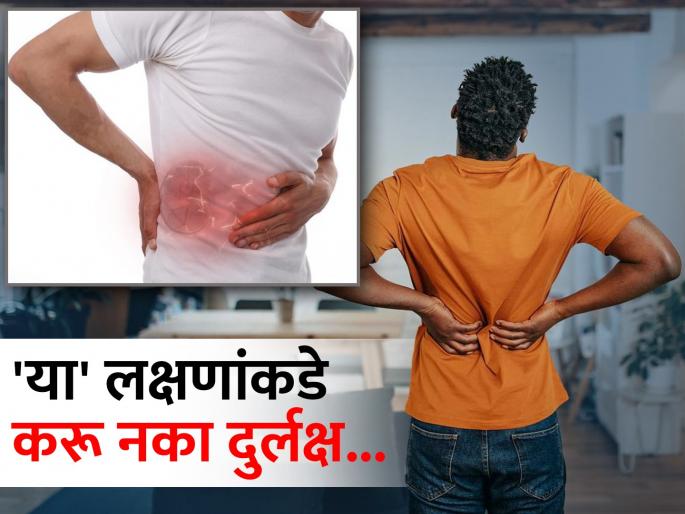Early signs of kidney related disease know it | किडनीमध्ये सूज असेल तर दिसू लागतात ही लक्षणं, वेळीच व्हा सावध नाही तर... Early signs of kidney related disease know it | किडनीमध्ये सूज असेल तर दिसू लागतात ही लक्षणं, वेळीच व्हा सावध नाही तर...