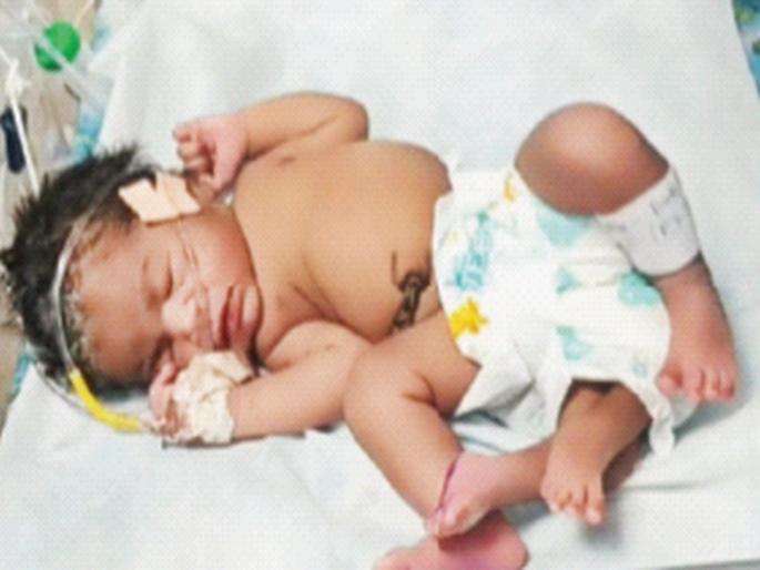 A woman gave birth to a 4-legged baby girl in Gwalior | ग्वाल्हेरात महिलेने दिला ४ पायांच्या मुलीला जन्म