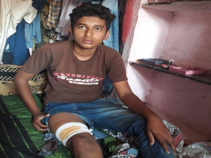 Dare! A Class X student sustained severe injuries while being injured in bear attack | धाडस ! अस्वलाच्या हल्ल्यात जखमी असतानाही दहावीच्या विद्यार्थ्याने केला जोरदार प्रतिकार  