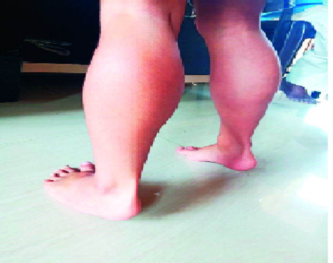 Disease that destroys the health of the entire household | संपूर्ण घराचेच स्वास्थ्य हरवणारा आजार : मुलाच्या संगोपनामध्ये पालकांची चौफेर कसोटी Disease that destroys the health of the entire household | संपूर्ण घराचेच स्वास्थ्य हरवणारा आजार : मुलाच्या संगोपनामध्ये पालकांची चौफेर कसोटी