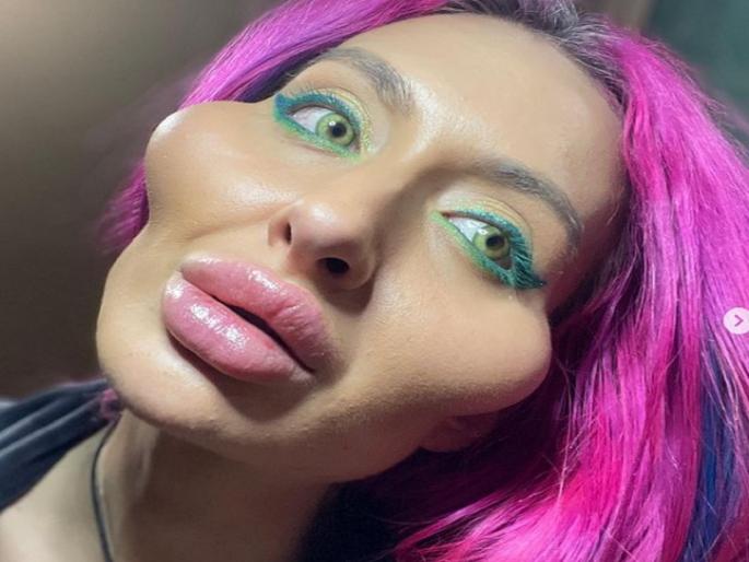 Model With 'World's Biggest Cheeks' Looks Unrecognisable In Pre-Surgery Pics | सुंदर दिसण्याच्या नादात केल्या शस्त्रक्रिया, आता ही मॉडेल दिसायला लागली अशी Model With 'World's Biggest Cheeks' Looks Unrecognisable In Pre-Surgery Pics | सुंदर दिसण्याच्या नादात केल्या शस्त्रक्रिया, आता ही मॉडेल दिसायला लागली अशी