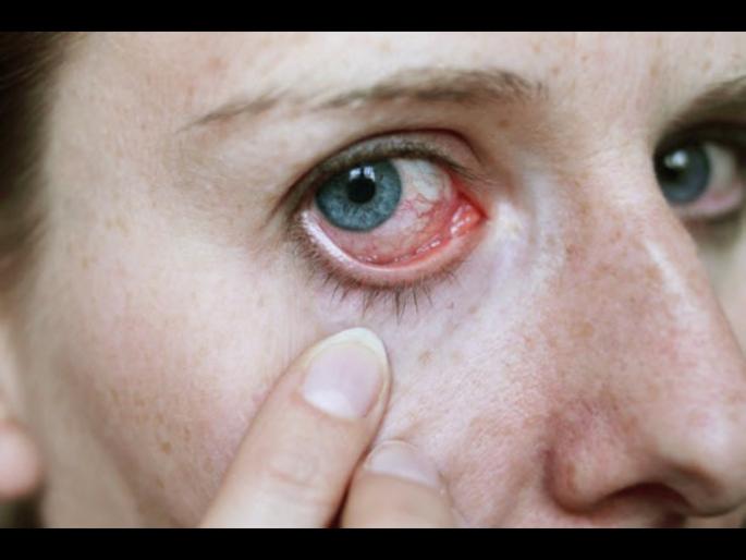 Diabetes symptoms : Eyes test could help to detect diabetes | डोळ्यांमध्येही दिसतात डायबिटीसचे हे संकेत, यांकडे अजिबात करू नका दुर्लक्ष Diabetes symptoms : Eyes test could help to detect diabetes | डोळ्यांमध्येही दिसतात डायबिटीसचे हे संकेत, यांकडे अजिबात करू नका दुर्लक्ष