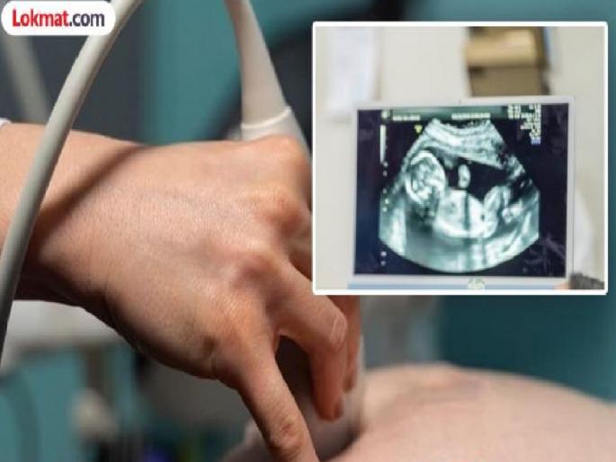 Abortion racket starts again after being released on bail, Swapnil Patil becomes a bogus doctor of MR in kolhapur | Kolhapur: जामिनावर सुटताच पुन्हा गर्भपाताचे रॅकेट सुरू, स्वप्निल पाटील एमआरचा बनला बोगस डॉक्टर 