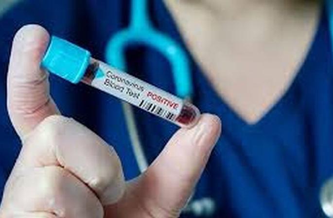 Corona's girth tight in Akola; Death of another; Seven new positives; The death toll is 30 | अकोल्यात कोरोनाचा विळखा घट्ट; आणखी एकाचा मृत्यू; सात नवे पॉझिटिव्ह; मृतकांचा आकडा ३० Corona's girth tight in Akola; Death of another; Seven new positives; The death toll is 30 | अकोल्यात कोरोनाचा विळखा घट्ट; आणखी एकाचा मृत्यू; सात नवे पॉझिटिव्ह; मृतकांचा आकडा ३०