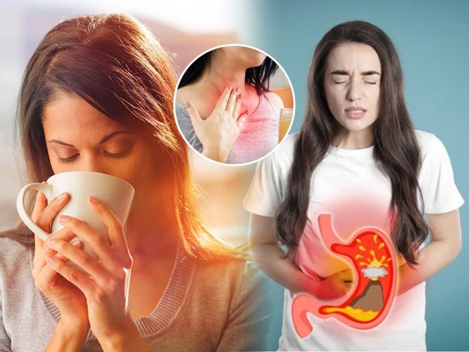Feel acidity or burning sensation in the chest after drinking tea Try this simple remedy monsoon tea tips for digestion | चहा प्यायल्यानंतर ॲसिडीटीचा त्रास- छातीत जळजळ होते? सोपा उपाय अन् पावसाळ्यात घ्या गरमागरम चहाचा आनंद