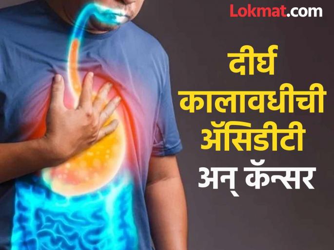 A question that haunts many; Why does bowel cancer occur even without addiction, know the reasons | अनेकांना पडलेला प्रश्न; व्यसन नसतानाही का होतो आतड्याचा कॅन्सर, जाणून घ्या कारणे A question that haunts many; Why does bowel cancer occur even without addiction, know the reasons | अनेकांना पडलेला प्रश्न; व्यसन नसतानाही का होतो आतड्याचा कॅन्सर, जाणून घ्या कारणे
