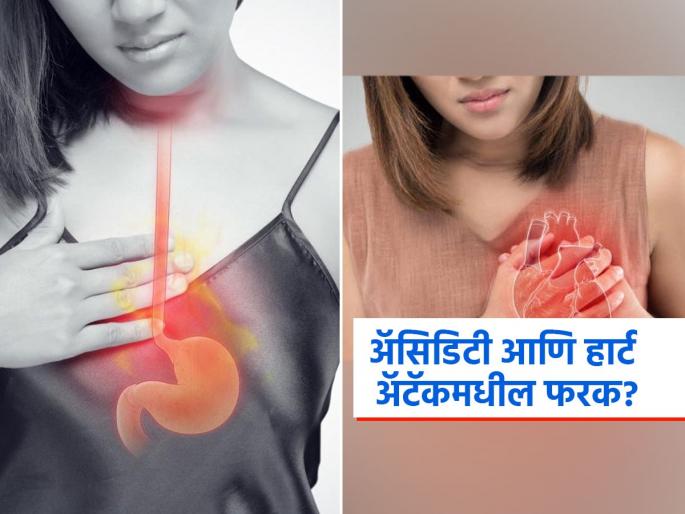 Symptoms of difference between heart attack and acidity | छातीत दुखणं म्हणजे हार्ट अ‍ॅटॅक आहे की अ‍ॅसिडिटी कसं ओळखाल? पाहा दोन्हीतील फरक