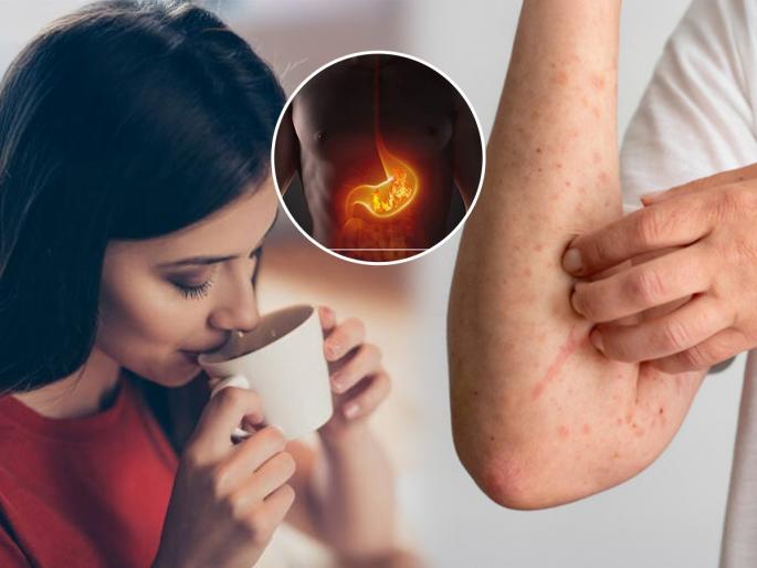 drinking tea at this time may cause problem, see what to do, how tea is harmful | एक कप चहा तुम्हाला देतोय जन्मभराचा आजार! ही छळणारी डोकेदुखी कायमची टाळायची तर..