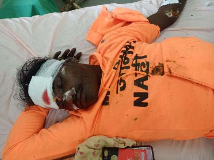 Three seriously injured in auto-bike accident |  ऑटो-दुचाकी अपघातात तीन जण गंभीर Three seriously injured in auto-bike accident |  ऑटो-दुचाकी अपघातात तीन जण गंभीर