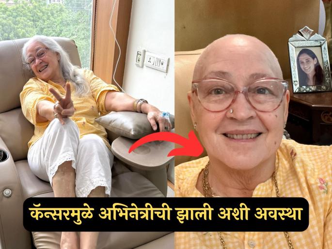 actress nafisa ali loses hair due to stage 4 cancer gets emotional sharing bald look | स्टेज ४ कॅन्सरमुळे प्रसिद्ध अभिनेत्रीचे केस गळाले; Bald लूक शेअर करत झाली भावुक, म्हणाली-