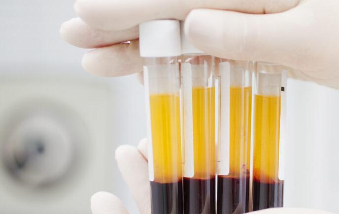 Nagpur is no longer a race for plasma for patients from Gondia district | गोंदिया जिल्ह्यातील रूग्णांची प्लाझ्मासाठी आता नागपूरची दौड नाही 