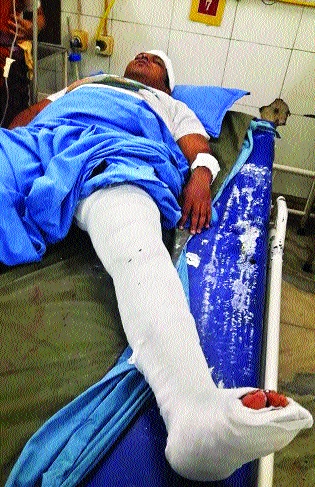 Victim's assault on husband's husband | वकिलाच्या पतीवर प्राणघातक हल्ला Victim's assault on husband's husband | वकिलाच्या पतीवर प्राणघातक हल्ला