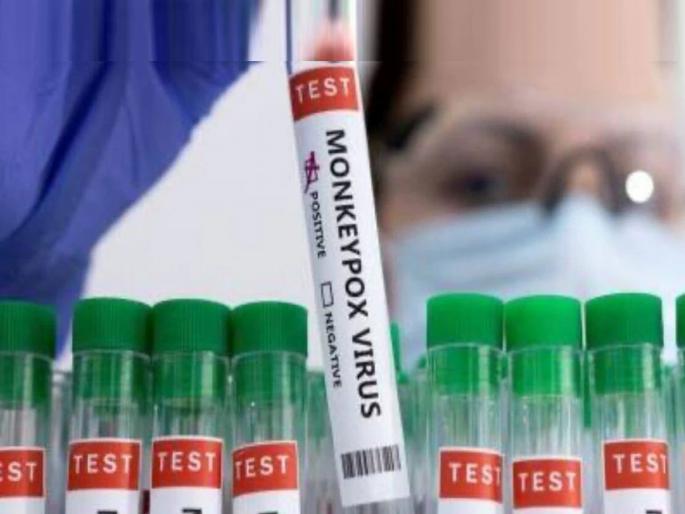 Monkeypox New Symptoms These new symptoms were seen in monkeypox patients will have to stay quarantine longer than Corona virus | Monkeypox New Symptoms: मंकीपॉक्स रुग्णांमध्ये दिसून आली ही नवी लक्षणं, कोरोनापेक्षाही अधिक दिवस राहावं लागणार क्वारंटाईन Monkeypox New Symptoms These new symptoms were seen in monkeypox patients will have to stay quarantine longer than Corona virus | Monkeypox New Symptoms: मंकीपॉक्स रुग्णांमध्ये दिसून आली ही नवी लक्षणं, कोरोनापेक्षाही अधिक दिवस राहावं लागणार क्वारंटाईन