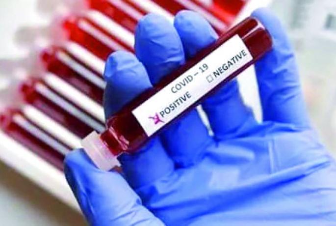 CoronaVirus in Nagpur: 419 new positive, 21 deaths | CoronaVirus in Nagpur : ४१९ नवे पॉझिटिव्ह, २१ रुणांचा मृत्यू CoronaVirus in Nagpur: 419 new positive, 21 deaths | CoronaVirus in Nagpur : ४१९ नवे पॉझिटिव्ह, २१ रुणांचा मृत्यू