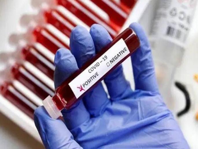 CoronaVirus News: 114 women die of corona in Goa in two and a half months | CoronaVirus News: गोव्यात अडिच महिन्यांत ११४ महिलांचे कोरोनाने मृत्यू CoronaVirus News: 114 women die of corona in Goa in two and a half months | CoronaVirus News: गोव्यात अडिच महिन्यांत ११४ महिलांचे कोरोनाने मृत्यू