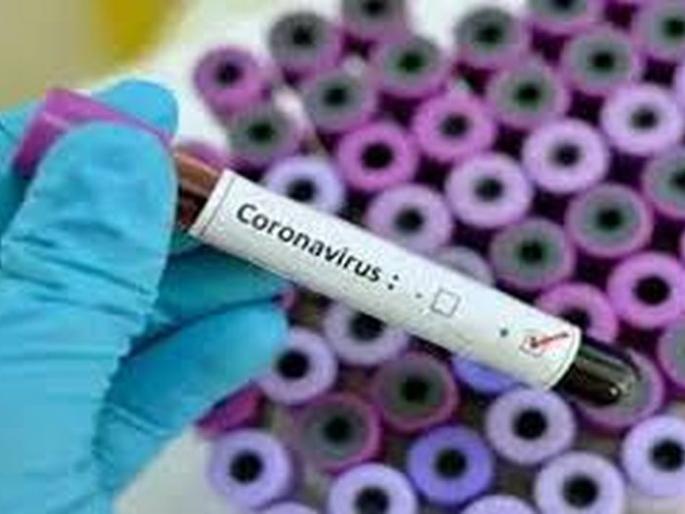 CoronaVirus in Akola : Eight more positives; Total number of patients 137 | CoronaVirus in Akola : अकोल्यात आणखी आठ पॉझिटिव्ह; एकूण रुग्णसंख्या १३७ CoronaVirus in Akola : Eight more positives; Total number of patients 137 | CoronaVirus in Akola : अकोल्यात आणखी आठ पॉझिटिव्ह; एकूण रुग्णसंख्या १३७