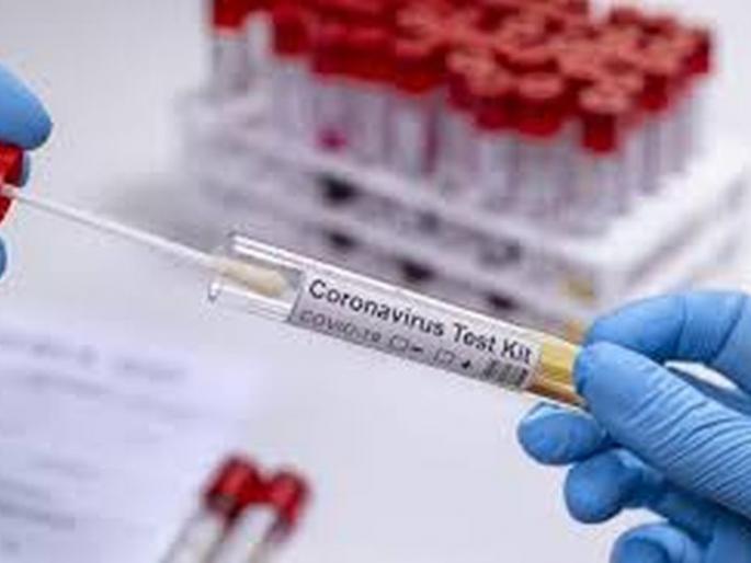 Another 16 corona positive in Akola district | अकोला जिल्ह्यात आणखी १६ कोरोना पॉझिटिव्ह Another 16 corona positive in Akola district | अकोला जिल्ह्यात आणखी १६ कोरोना पॉझिटिव्ह