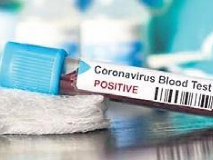Another 12 corona positive patients were found in Akola district | अकोला जिल्ह्यात आणखी १२ कोरोना पॉझिटिव्ह रुग्ण आढळले Another 12 corona positive patients were found in Akola district | अकोला जिल्ह्यात आणखी १२ कोरोना पॉझिटिव्ह रुग्ण आढळले