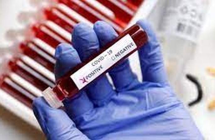 Corona Cases: Another 293 corona positive patients in Akola | Corona Cases अकोल्यात आणखी २९३ कोरोना पॉझिटिव्ह रुग्णांची भर
