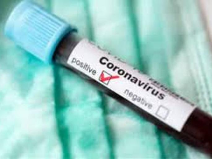 Another 28 corona positive patients were found in Akola district | अकोला जिल्ह्यात आणखी २८ कोरोना पॉझिटिव्ह रुग्ण आढळले Another 28 corona positive patients were found in Akola district | अकोला जिल्ह्यात आणखी २८ कोरोना पॉझिटिव्ह रुग्ण आढळले
