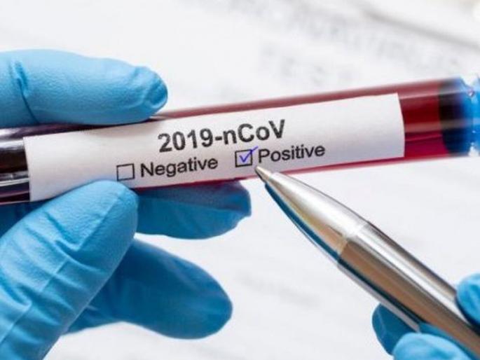 CoronaVirus: 27 more positive patients in Akola district | CoronaVirus : अकोला जिल्ह्यात आणखी २७ पॉझिटिव्ह रुग्णांची भर CoronaVirus: 27 more positive patients in Akola district | CoronaVirus : अकोला जिल्ह्यात आणखी २७ पॉझिटिव्ह रुग्णांची भर