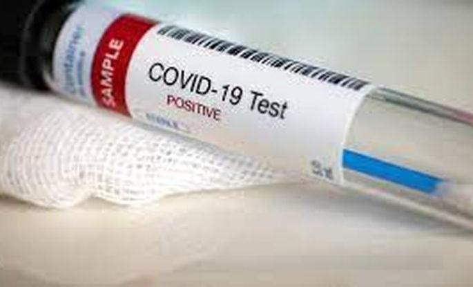 Corona: Akola has the lowest recovery rate in Vidarbha | कोरोना: विदर्भात सर्वात कमी रिकव्हरी रेट अकोल्याचा