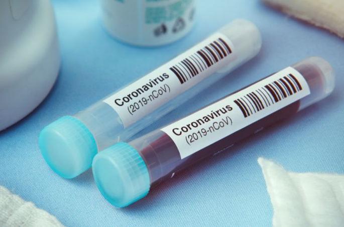 Another 65 corona positive patients in Akola district | अकोला जिल्ह्यात आणखी ६५ कोरोना पॉझिटिव्ह रुग्णांची भर Another 65 corona positive patients in Akola district | अकोला जिल्ह्यात आणखी ६५ कोरोना पॉझिटिव्ह रुग्णांची भर