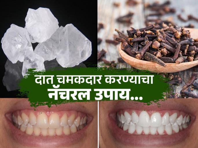 Expert tells how to use clove and fitkari for whiten teeth | तुरटी आणि लवंग म्हणजे दातांसाठी वरदान, पिवळे दात होतील शुभ्र चमकदार-पाहा उपाय