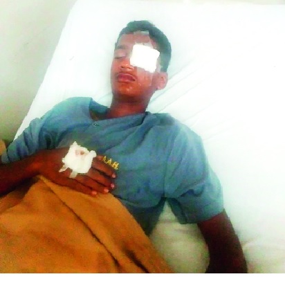 Mobile eruption of child's eye: - Part of the explosion occurred while blaming the game | मोबाईलच्या स्फोटाने मुलाचा डोळा निकामी--: गेम खेळत असताना स्फोट होऊन पार्टचा तुकडा घुसला Mobile eruption of child's eye: - Part of the explosion occurred while blaming the game | मोबाईलच्या स्फोटाने मुलाचा डोळा निकामी--: गेम खेळत असताना स्फोट होऊन पार्टचा तुकडा घुसला